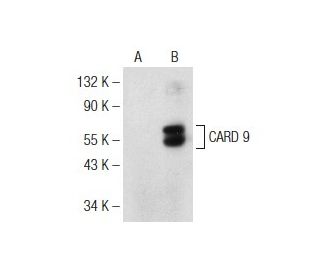 CARD 9 Antibody (C-2) - Western Blotting - Image 147364