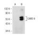 CARD 9 Antibody (C-2) - Western Blotting - Image 147364