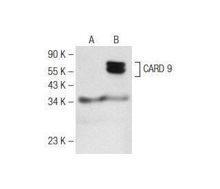 CARD 9 Antibody (F-4) - Western Blotting - Image 142537