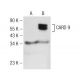 CARD 9 Antibody (F-4) - Western Blotting - Image 142537