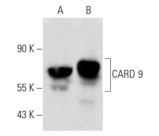 CARD 9 Antibody (A-8) - Western Blotting - Image 357311SAM Transcription Activation: SAM system utilizing dCas9-VP64, MS2-P65-HSF1, and sgRNA for precise gene transcription activation.