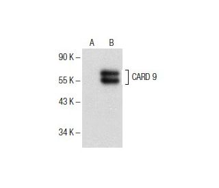 CARD 9 Antibody (A-8) - Western Blotting - Image 151579