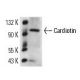 Cardiotin Antibody (SR-2) - Western Blotting - Image 14028