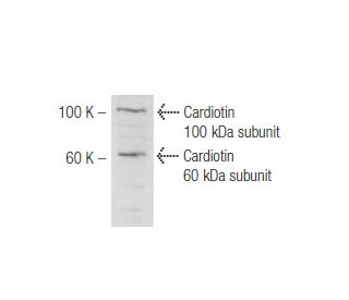Cardiotin Antibody (SR-3) - Western Blotting - Image 47814