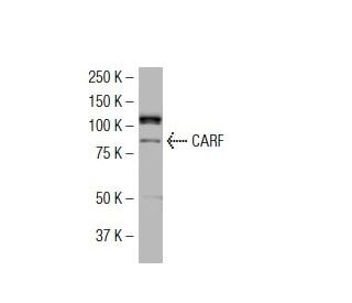 CARF Antibody (14.4) - Western Blotting - Image 34566 
