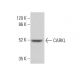 CARKL Antibody (H-5) - Western Blotting - Image 378172