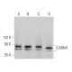 western blotting image from recommended CARM1 (D-6) monoclonal antibody replacement. Image 363716