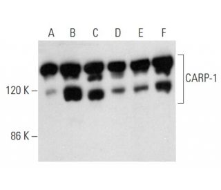 CARP-1 Antibody (E-4) - Western Blotting - Image 354246 