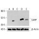 CARP Antibody (E-3): sc-398139. Western blot analysis of CARP expression in untreated HeLa (A), chemically-treated HeLa (B), untreated HCT-116 (C) and chemically-treated HCT-116 (D, E) whole cell lysates. β-Actin (C4): sc-47778 used as loading control. Detection reagent used: m-IgG Fc BP-HRP: sc-525409. CARP Antibody (E-3) - Western Blotting - Image 415384