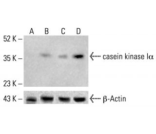 casein kinase Iα Antibody (H-7) - Western Blotting - Image 412684