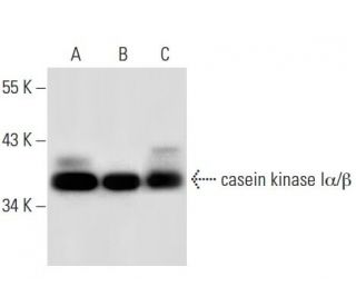 western blotting image from recommended casein kinase I&alpha; (H-7) monoclonal antibody replacement. Image 30303