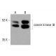 Anticorps anti-caséine kinase Iδ (C-4): sc-514942. Analyse par Western blot de l'expression de la caséine kinase Iδ dans des lysats cellulaires complets de HeLa (A) et HCT-116 (B). Réactif de détection utilisé: m-IgG3 BP-HRP: sc-533670. casein kinase Iδ Antibody (C-4) - Western Blotting - Image 415727