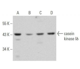 western blotting image from recommended casein kinase Iδ (C-8) monoclonal antibody replacement. Image 355293