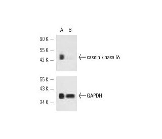 casein kinase I&delta; siRNA (h): sc-29910. Western blot analysis of casein kinase I&delta; expression in non-transfected 