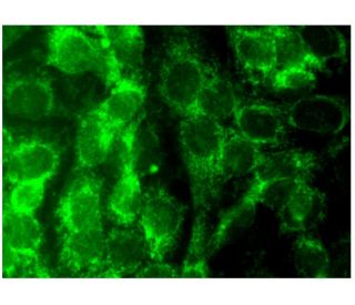 immunofluorescence image from recommended casein kinase Iε (A-2) monoclonal antibody replacement. Image 297231