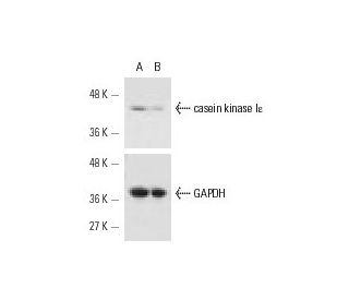 casein kinase I&epsilon; siRNA (h): sc-29914. Western blot analysis of casein kinase I&epsilon; expression in non-transfec 