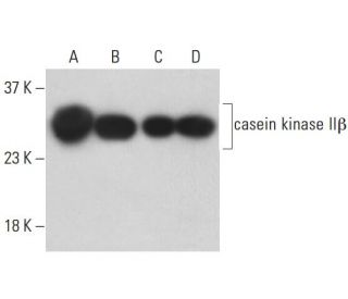casein kinase IIβ Antibody (6D5) - Western Blotting - Image 398524