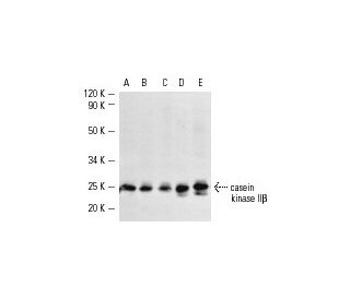 western blotting image from recommended casein kinase II&beta; (6D5) monoclonal antibody replacement. Image 2182