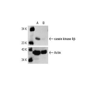 casein kinase II&beta; siRNA (h): sc-29916. Western blot analysis of casein kinase II&beta; expression in non-transfected 
