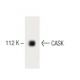 CASK Antibody (7) - Western Blotting - Image 60257
