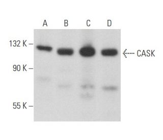 western blotting image from recommended CASK (C-6) monoclonal antibody replacement. Image 357229