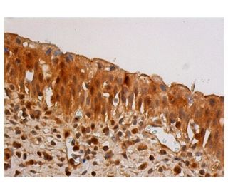 immunohistochemistry image from recommended caspase-1 (D-3) monoclonal antibody replacement. Image 348061