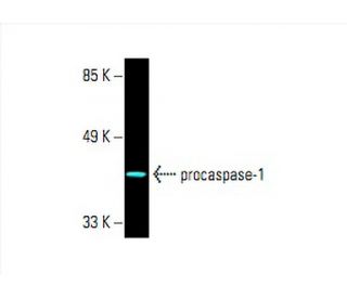 caspase-1 p20 Antibody (D-4) | SCBT - Santa Cruz Biotechnology