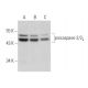 This polyclonal antibody has been discontinued. See our recommended <a href="caspase-2-antibody-f-2">caspase-2 (F-2)</a> monoclonal antibody (sample data shown). western blotting image from recommended caspase-2 (F-2) monoclonal antibody replacement. Image 320268