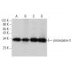 Cet anticorps polyclonal n'est plus commercialisé. Voir l'anticorps monoclonal <a href="caspase-3-p17-antibody-b-4">caspase-3 p17 (B-4)</a> que nous recommandons (données d'échantillonnage indiquées). western blotting image from recommended caspase-3 p17 (B-4) monoclonal antibody replacement. Image 377405