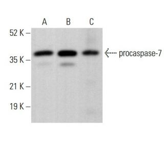 caspase-7 Antibody (10.1.60) - Western Blotting - Image 380680Each CRISPR/Cas9 Knockout (KO) Plasmid product consists of a pool of 3 plasmids designed to ensure identification and cleavage of a specific gene for maximum knockout efficiency. Each plasmid encodes a unique 20 nt sequence derived from the GeCKO (v2) library.