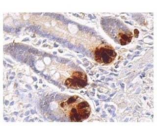 Caspase 8/p43/p18 antibody (13423-1-AP)