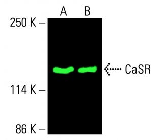 CaSR Antibody (6D4) - Western Blotting - Image 416162
