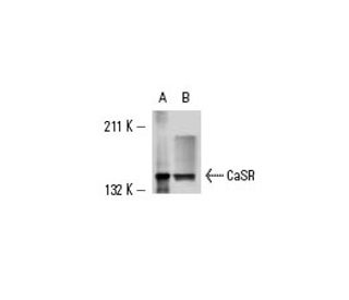 western blotting image from recommended CaSR (6D4) monoclonal antibody replacement. Image 12663