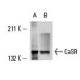 Este anticuerpo policlonal ha dejado de fabricarse. Consulta nuestro anticuerpo monoclonal recomendado <a href="casr-antibody-6d4">CaSR (6D4)</a> (se muestran datos de muestra). western blotting image from recommended CaSR (6D4) monoclonal antibody replacement. Image 12663