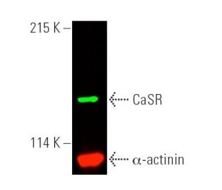 CaSR Antibody (6D4) - Western Blotting - Image 389679