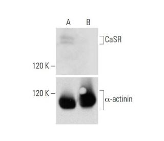 CaSR HDR Plasmid (h): sc-401749-HDR. Western blot analysis of CaSR... 