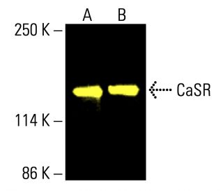 CaSR Antibody (6D4) - Western Blotting - Image 416163