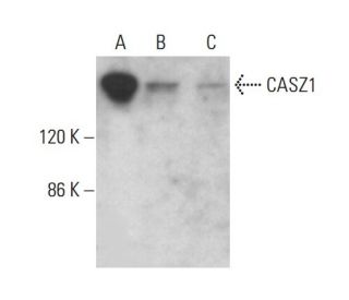 CASZ1 Antibody (B-11) - Western Blotting - Image 382673SAM Transcription Activation: SAM system utilizing dCas9-VP64, MS2-P65-HSF1, and sgRNA for precise gene transcription activation. 
