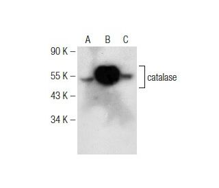 Albert様*:✼. aldolase-c-antibody-h-11-