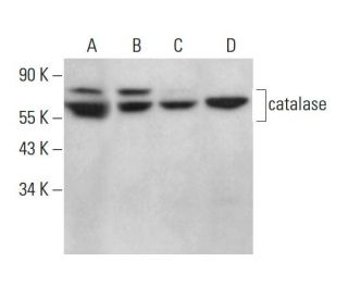 Albert様*:✼. catalase (H-9) Antibody sc-271803 from Santa Cruz