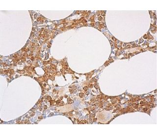 catalase Antibody (A-7) | SCBT - Santa Cruz Biotechnology