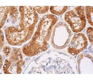 catalase Antibody (A-7) | SCBT - Santa Cruz Biotechnology