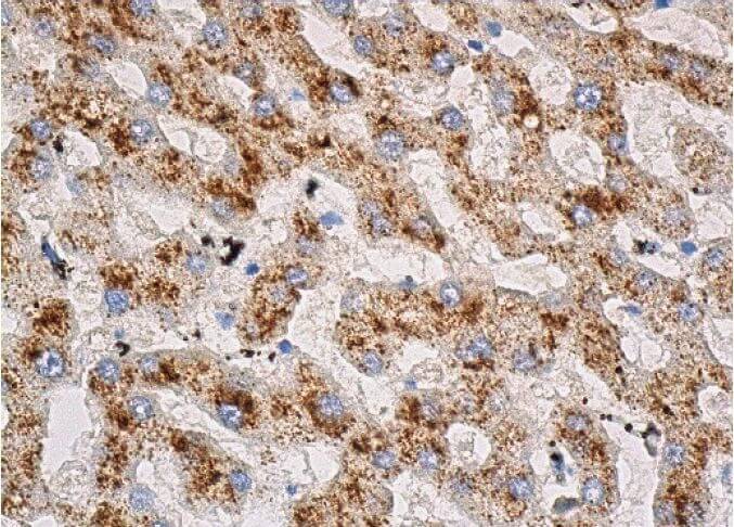 catalase Antibody (A-7) | SCBT - Santa Cruz Biotechnology