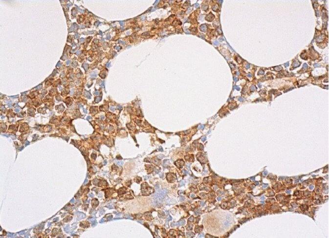 user_abb42bd5ページ catalase Antibody (A-7) | SCBT - Santa Cruz Biotechnology