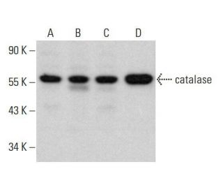 catalase Antibody (A-7) - Western Blotting - Image 352053 