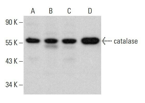 user_abb42bd5ページ catalase Antibody (A-7) | SCBT - Santa Cruz Biotechnology