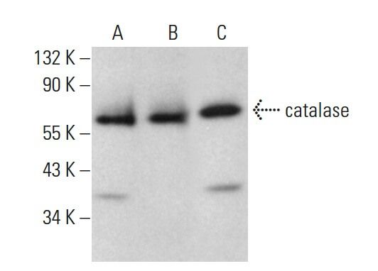 catalase Antibody (E-7) | SCBT - Santa Cruz Biotechnology