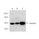western blotting image from recommended catalase (H-9) monoclonal antibody replacement. Image 137520