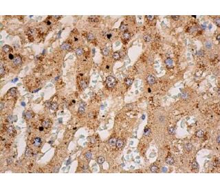 catalase Antibody (H-9) | SCBT - Santa Cruz Biotechnology catalase Antibody (H-9) | SCBT - Santa Cruz Biotechnology