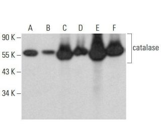 catalase Antibody (H-9) | SCBT - Santa Cruz Biotechnology